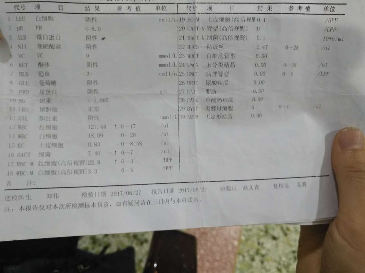 昨天发现有血尿,像洗肉水,有时又像茶叶水,肉眼看很.